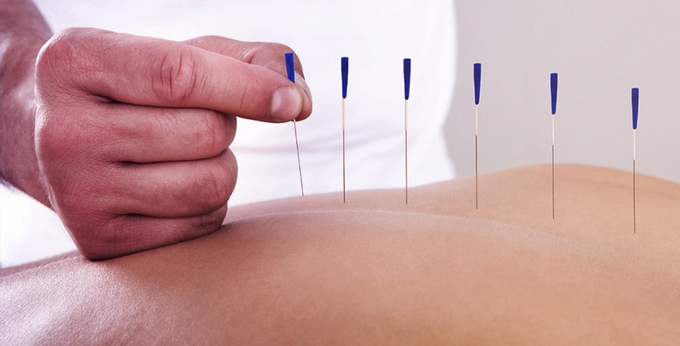 dia mundial 24 de octubre: Día Mundial de la Acupuntura