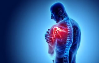 Eficacia de la acupuntura en el tratamiento del hombro congelado