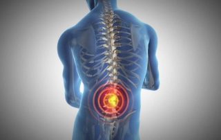 Estudio comparativo de electroacupuntura (EA) frente a la electroestimulación neuromuscular para el tratamiento del dolor lumbar crónico