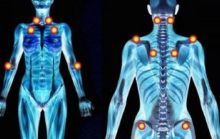 Acupuntura en el tratamiento de la fibromialgia: revisión sistemática y metaanálisis de ensayos clínicos