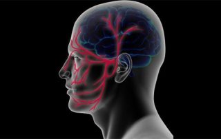 Comparación de la eficacia de la acupuntura y la carbamacepina en el tratamiento de la neuralgia del trigémino