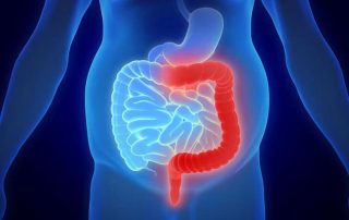 Acupuntura en el tratamiento de la colitis ulcerosa: revisión sistemática y metaanálisis