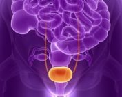 Eficacia de la acupuntura en el tratamiento del síndrome de vejiga dolorosa femenina refractaria