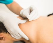 Mapping de revisiones sistemáticas sobre las evidencias científicas en acupuntura