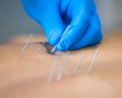 Uso de la acupuntura para condiciones de salud en adultos, 2013 a 2021: revisión sistemática