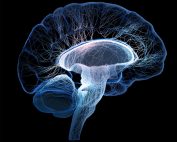 Neuroimagen y acupuntura en el deterioro cognitivo postictus