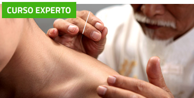 Curso de Experto en Acupuntura Clínica