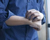Acupuntura para la urticaria crónica: revisión sistemática y metaanálisis con análisis secuencial de ensayos